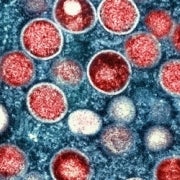 the monkeypox virus